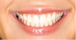 Pennington Dental Care in Pennington NJ